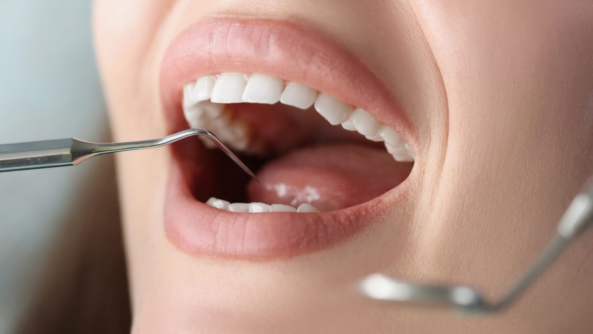 Oral health check up