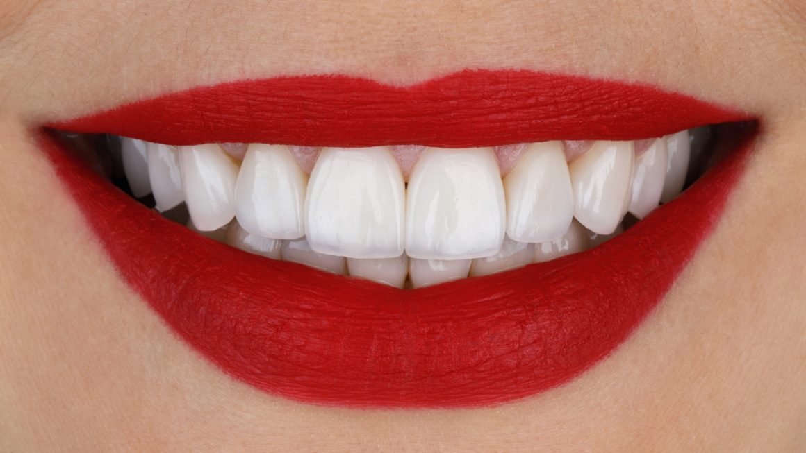 วีเนียร์