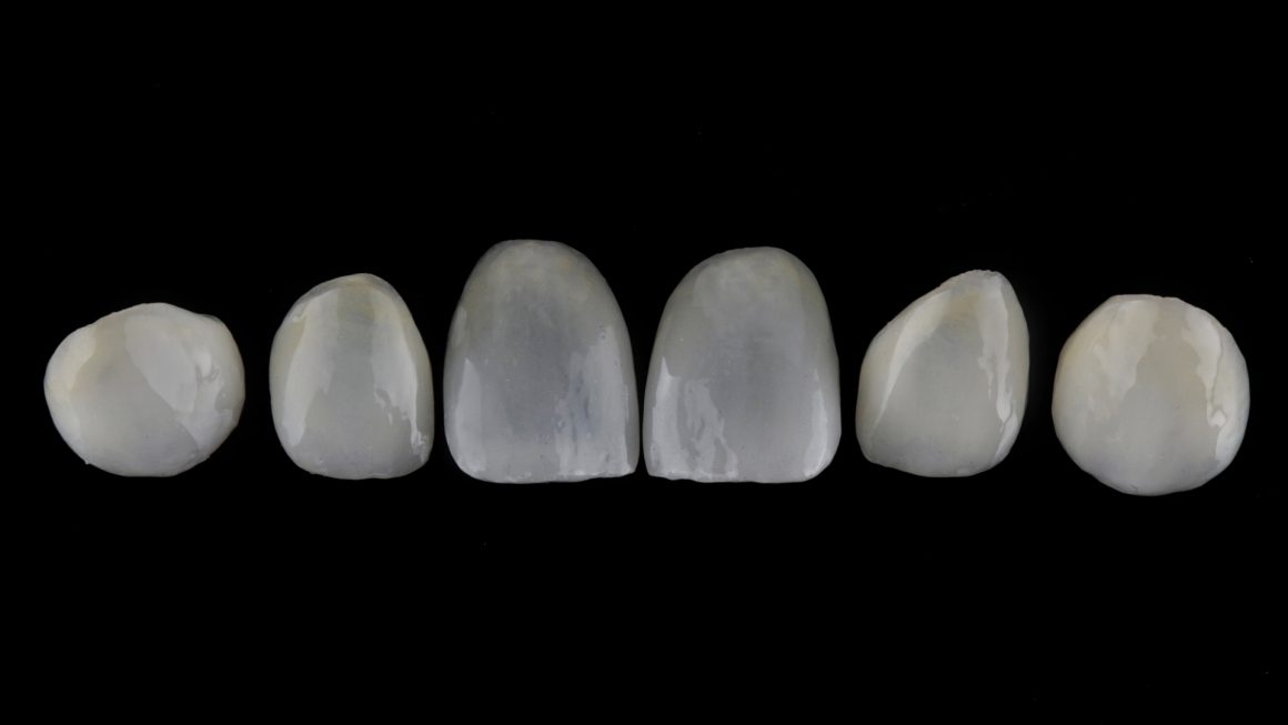 วีเนียร์