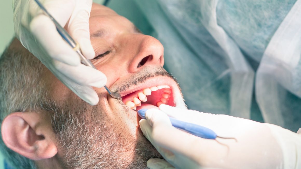 ขูดหินปูน